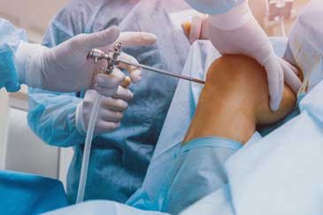 arthroscopy of the knee, orthopedic services