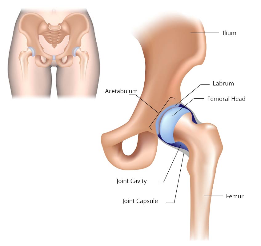 hip pain, hip replacement surgeries