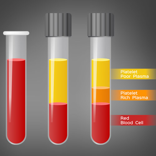 what is prp, platelet rich plasma, prp therapy in orlando