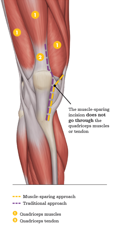 backinactionknee